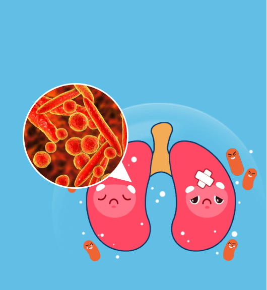 Mycoplasma & Pneumonia
