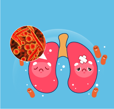 Mycoplasma & Pneumonia