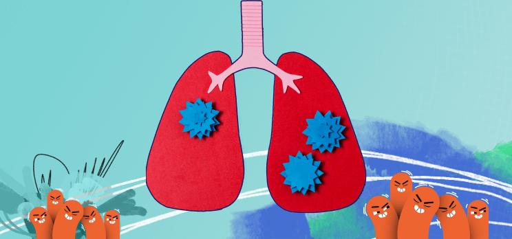 Pneumonia Mycoplasma